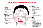 面部色斑与痤疮的产生分析图