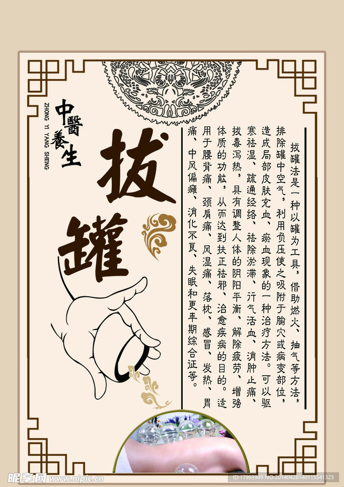拔罐