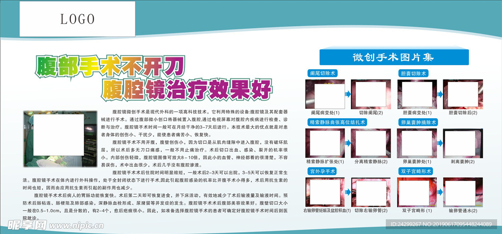 腹部手術