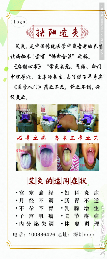 艾灸展架
