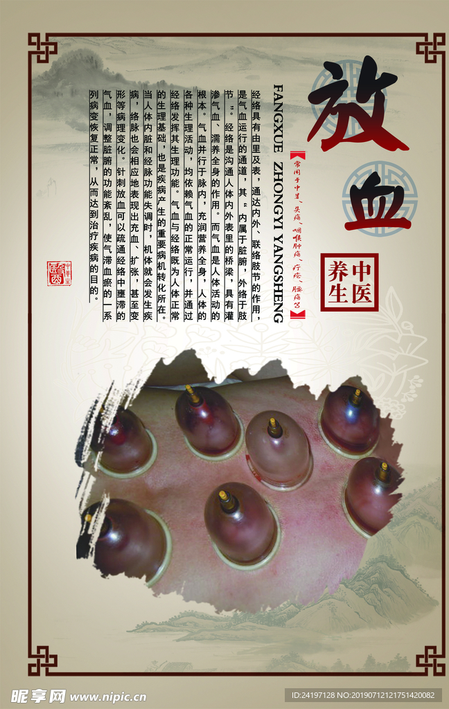中醫(yī)展板 放血
