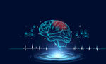 大脑诊疗科技