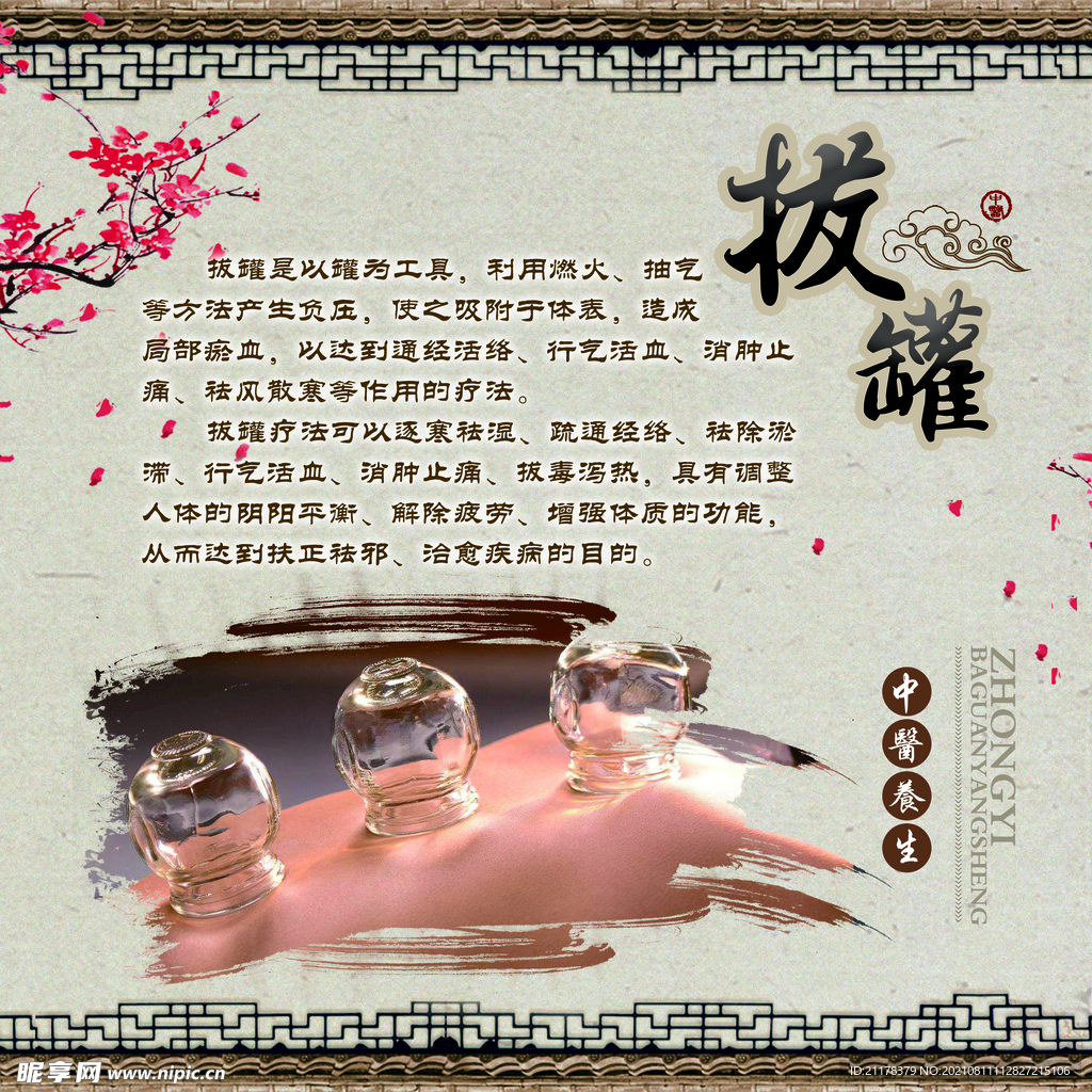 拔罐