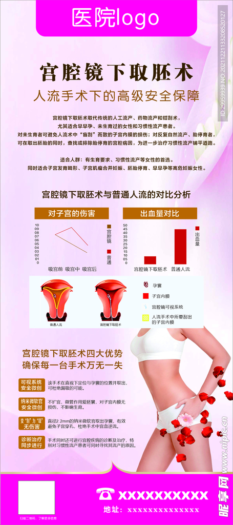 宮腔鏡海報
