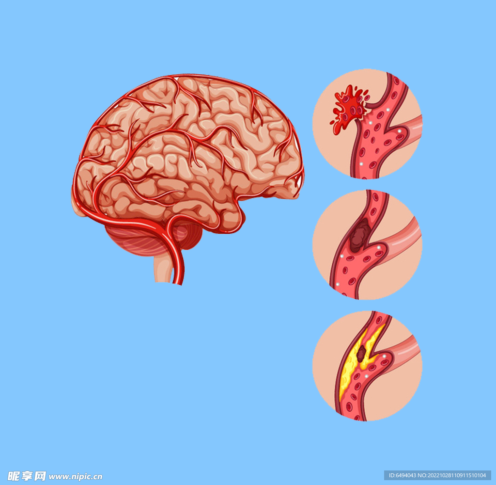大脑解剖脑浆疾病分析