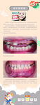 前牙透明管龋齿乳牙