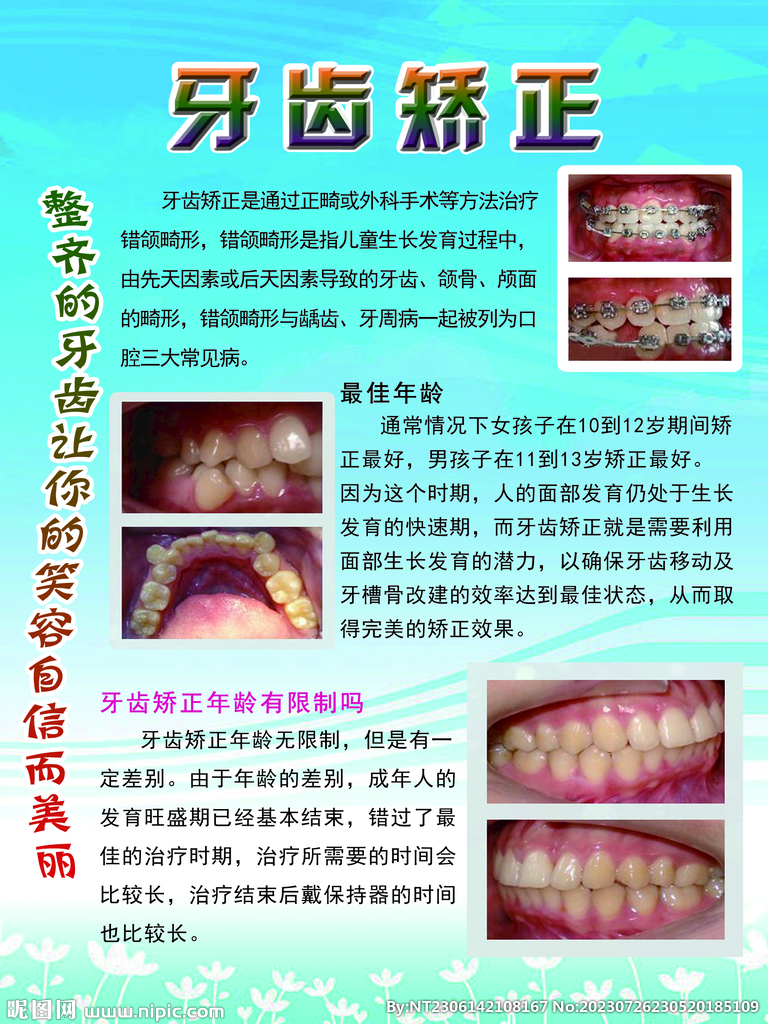 牙齒矯正展板