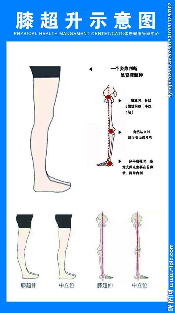膝超升示意圖