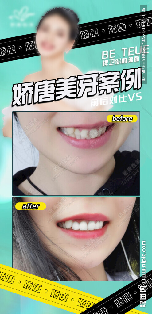 牙齿美容案例对比