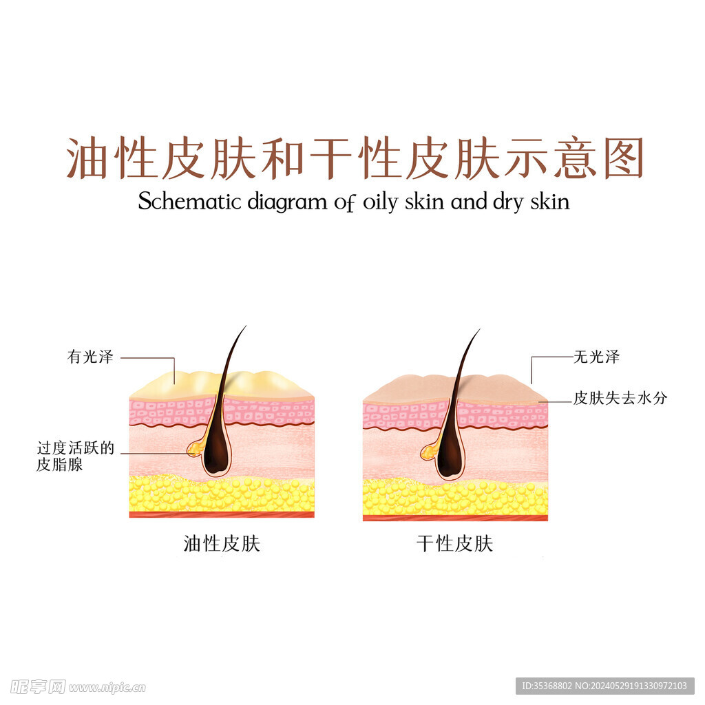油性 干性皮膚對比