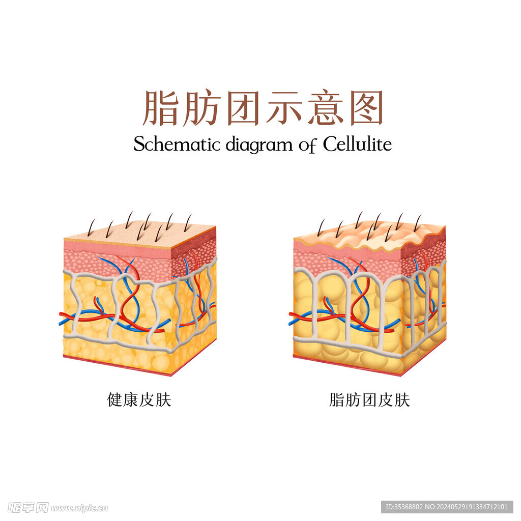 脂肪對比