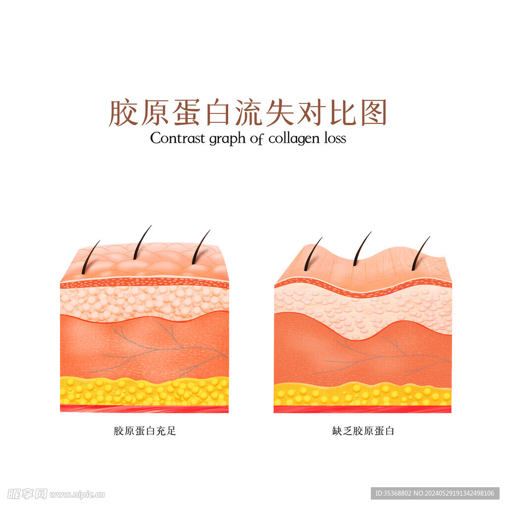 膠原蛋白