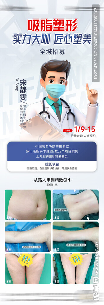 吸脂 醫(yī)美 整形