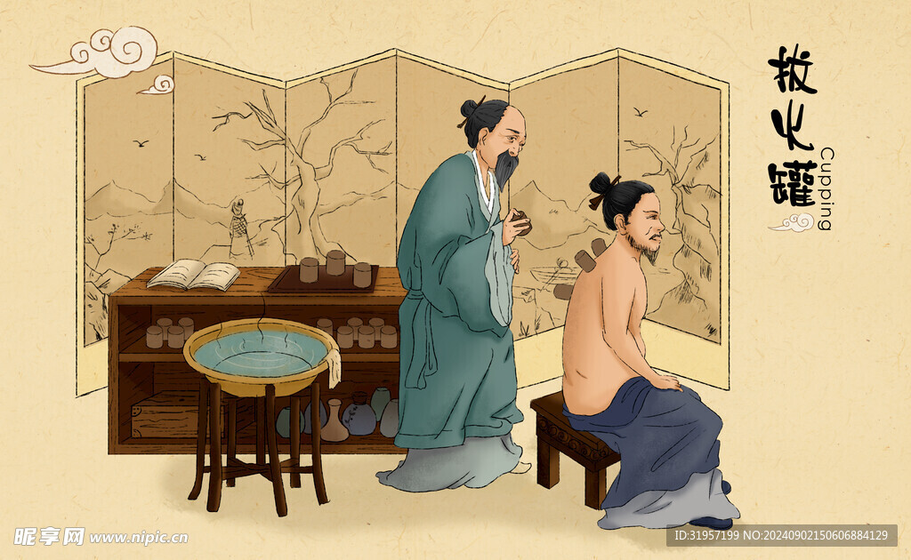 拔火罐