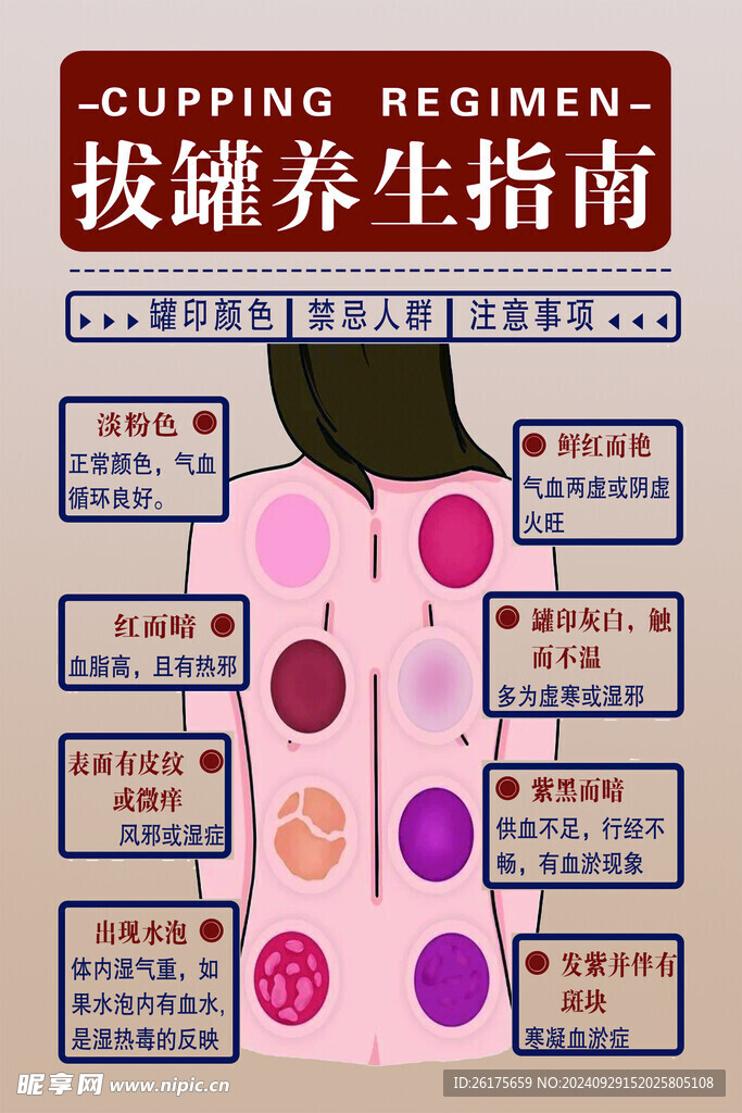 拔罐