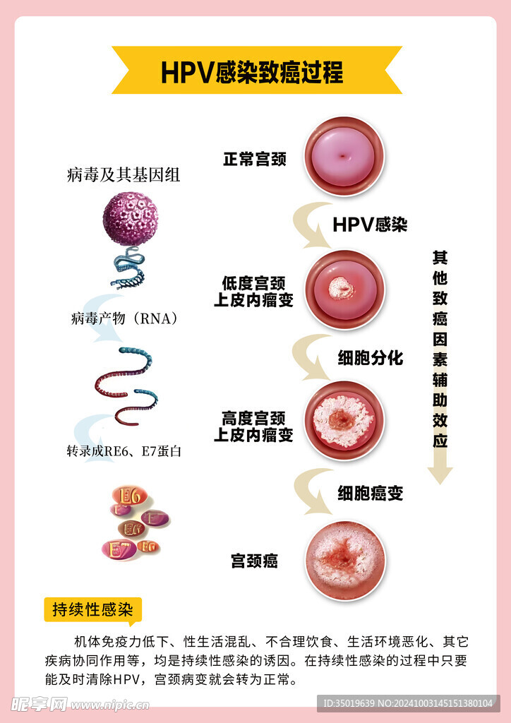 HPV感染過程