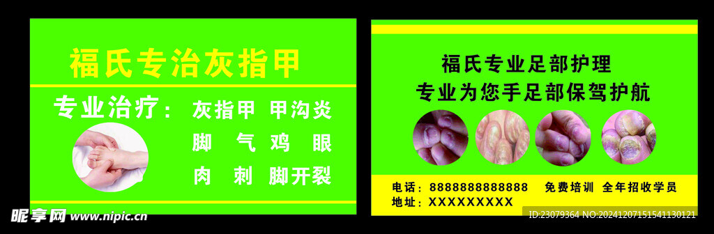 灰指甲名片