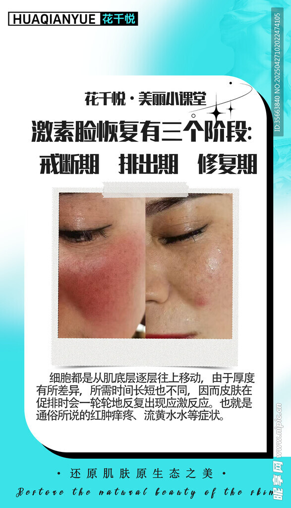 激素臉三個階段