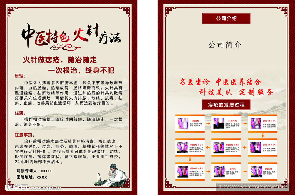 中醫特色火針治療痔瘡卡