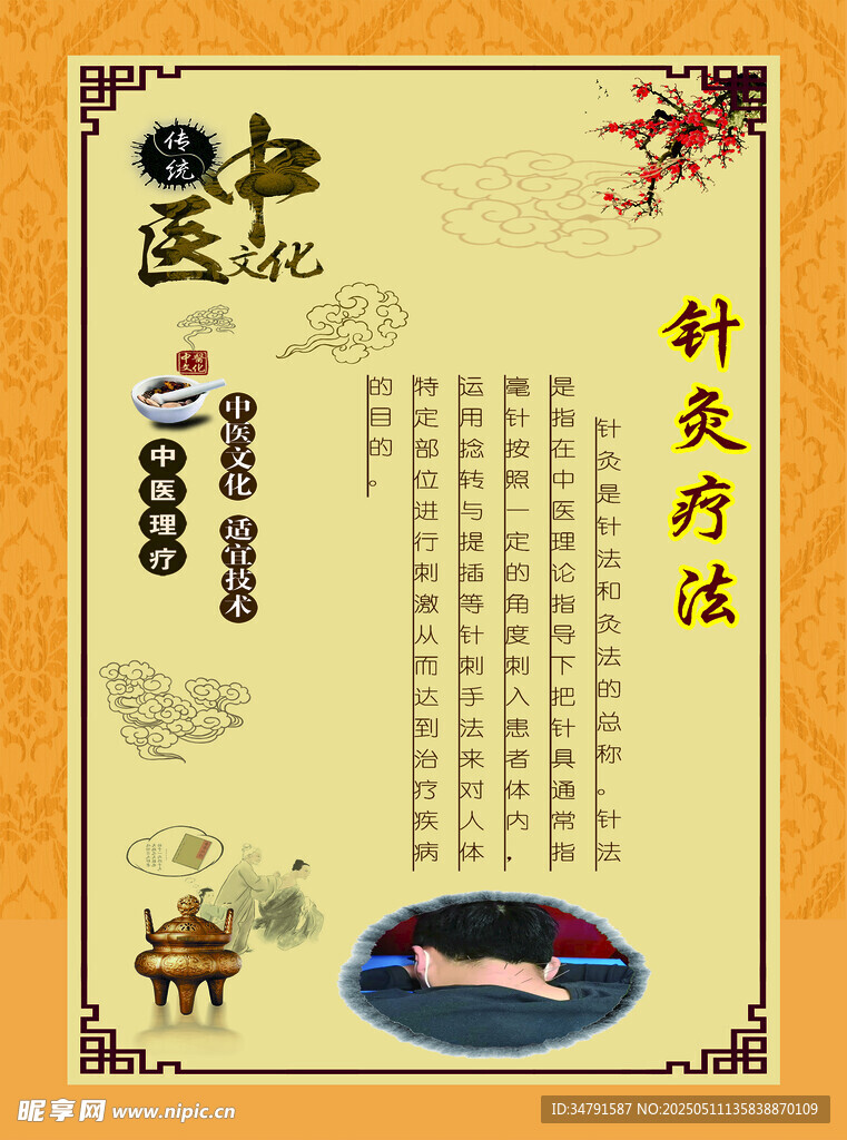 針灸療法宣傳海報