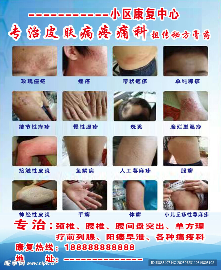 皮膚病 皮膚科