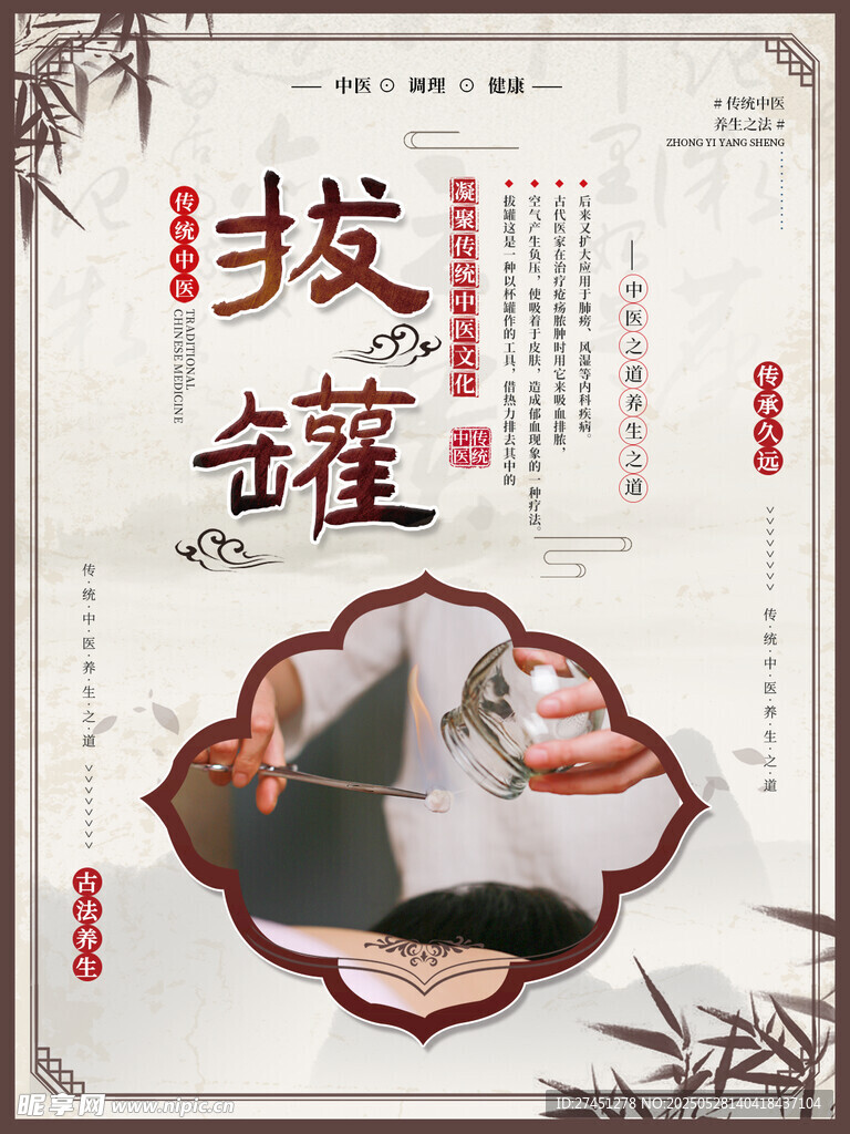 傳統(tǒng)中醫(yī)拔罐養(yǎng)生宣傳圖