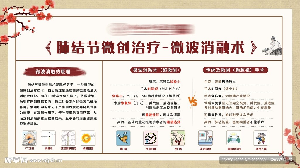 肺結(jié)節(jié)消融術(shù)