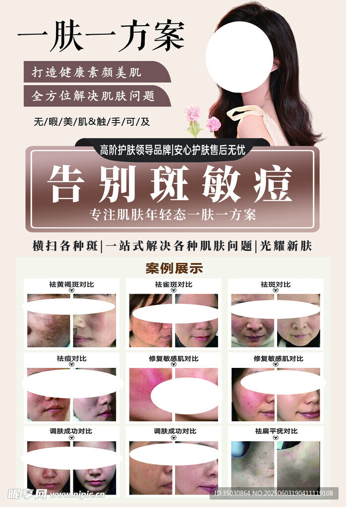 斑痘敏圖片