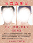 男女面痣圖