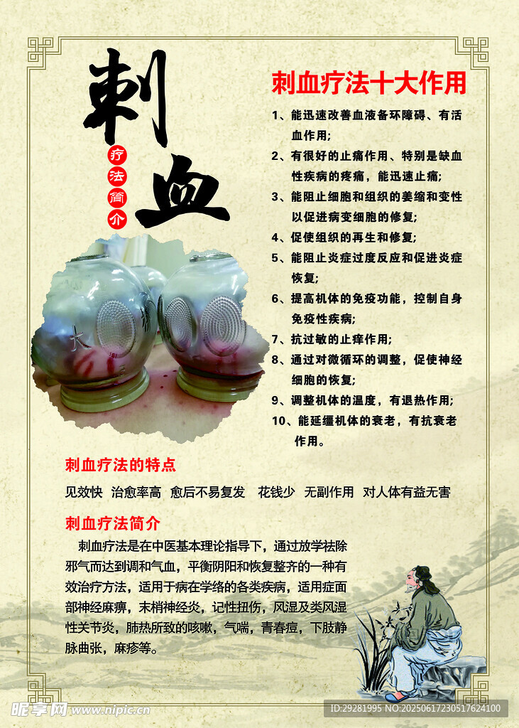 刺血療法介紹