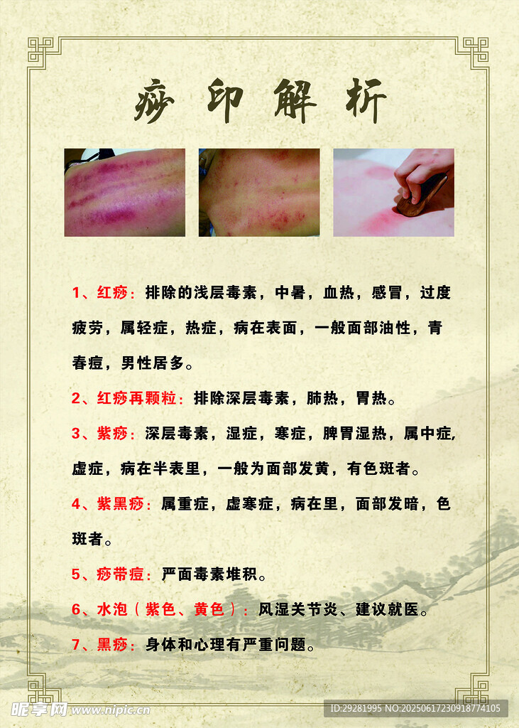 痧印解析