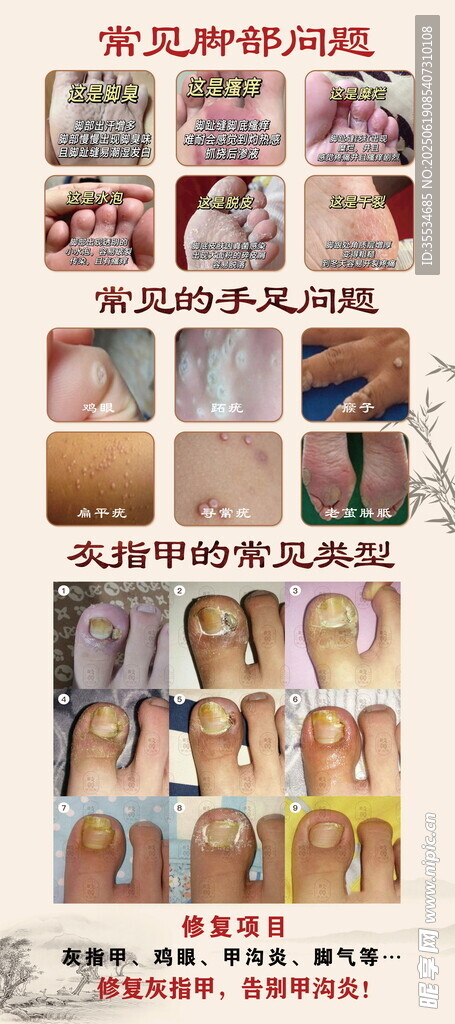 足療修腳店常見(jiàn)問(wèn)題宣傳展架
