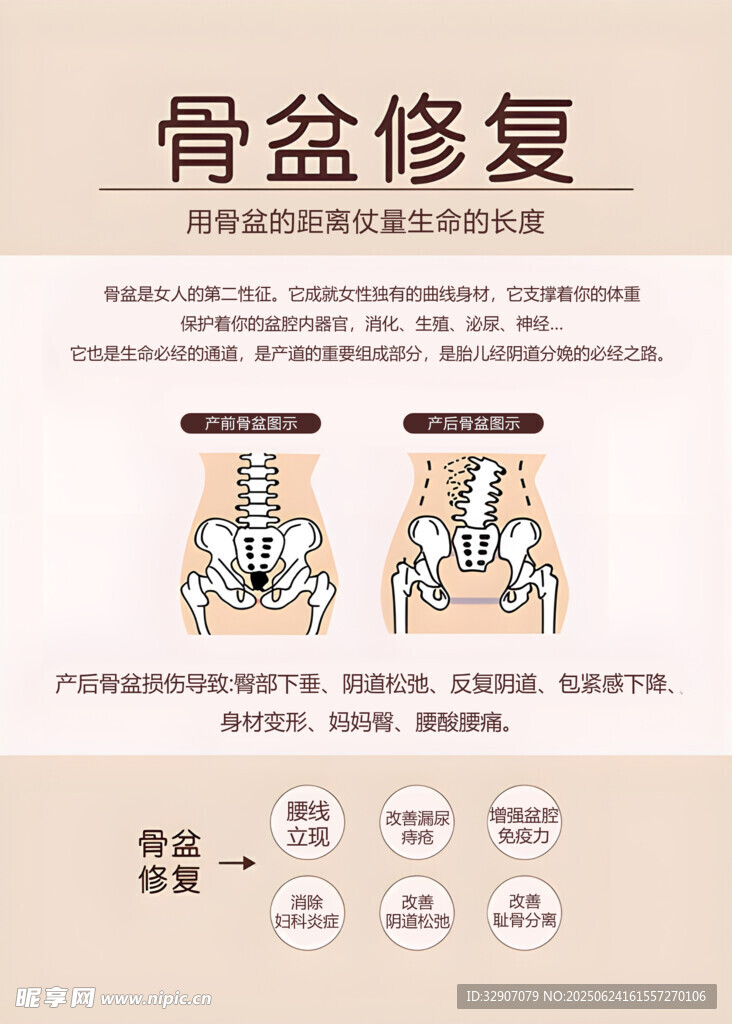 骨盆修復圖示講解