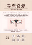子宮修復(fù)知識科普