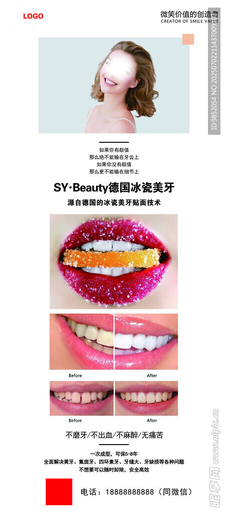 牙齒矯正前后對(duì)比展示