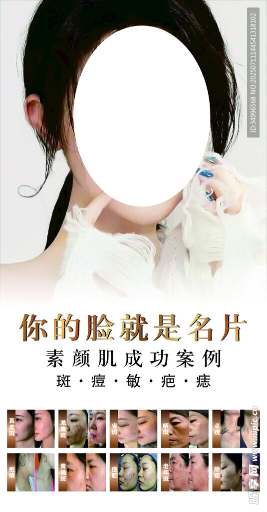 美容整形效果展示