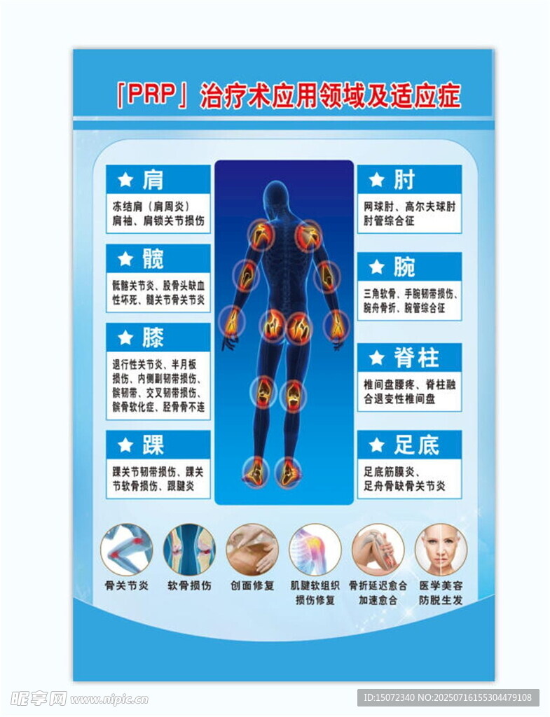 prp治療術(shù)