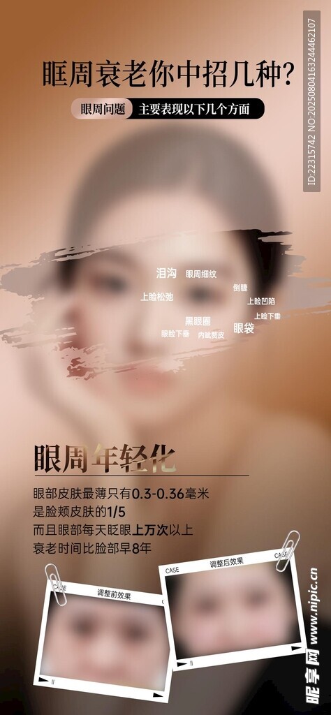 眼周年輕化海報(bào)