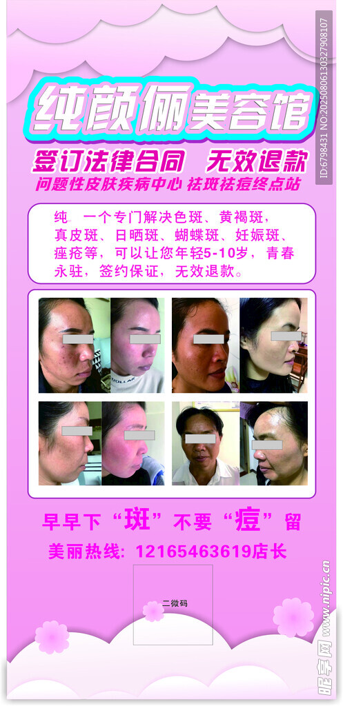 臉部祛斑美容效果展示