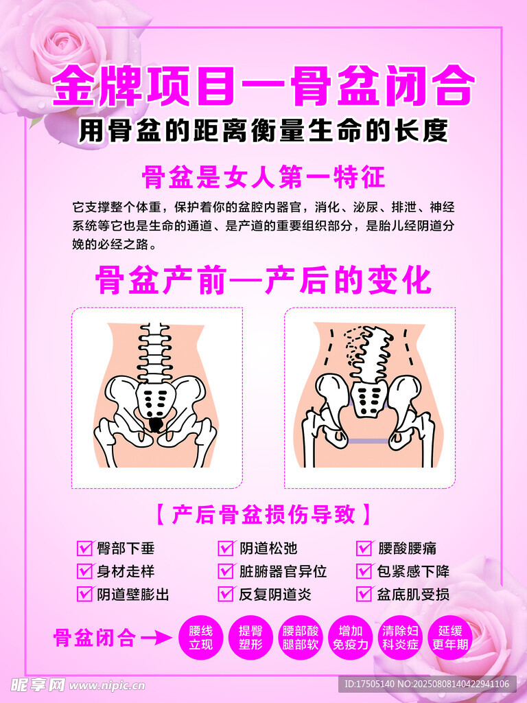 產(chǎn)后修復(fù)  骨盆閉合  