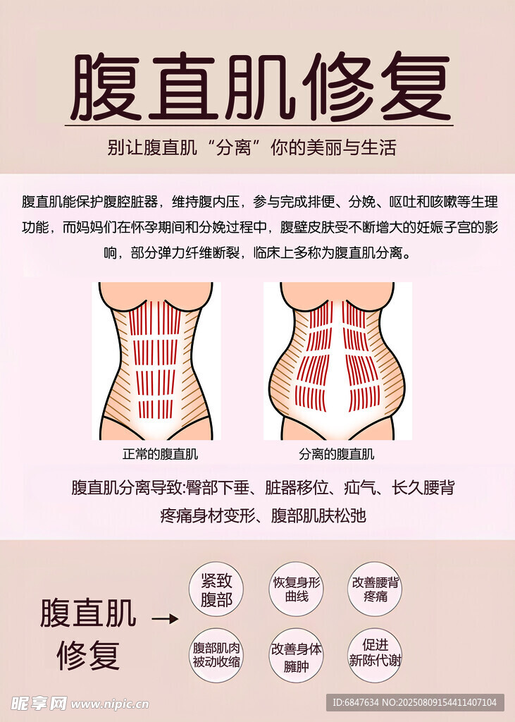 腹直肌修復(fù)
