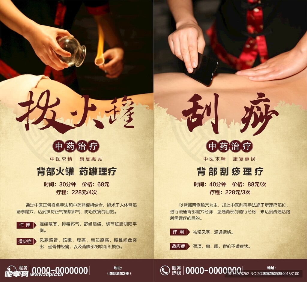 拔罐 刮痧