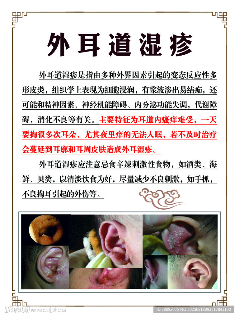 外耳道濕疹簡介