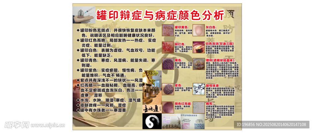 罐印辯癥與病癥顏色分析