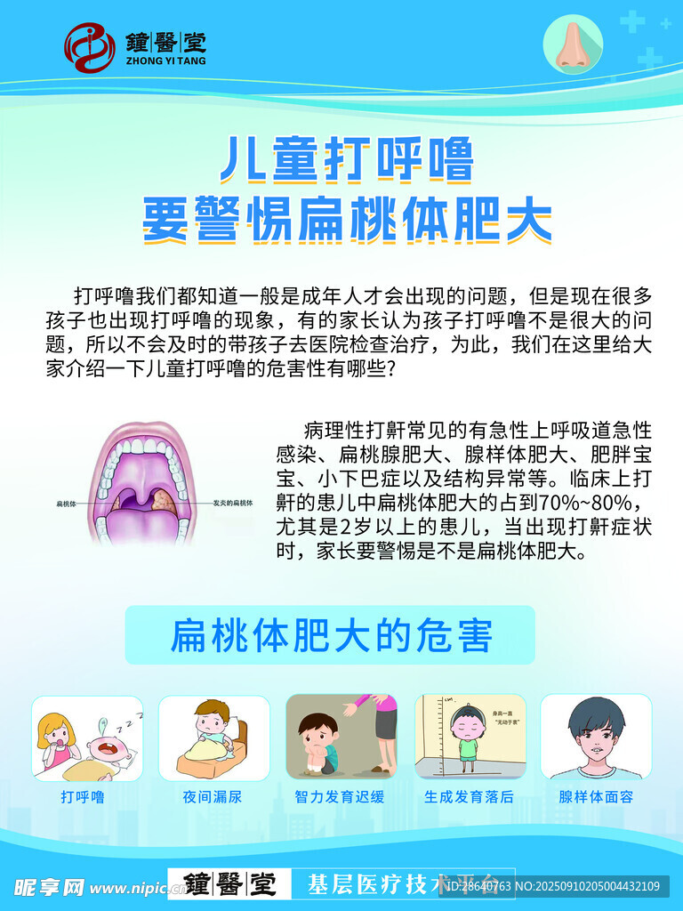 兒童打鼾警惕腺樣體肥大
