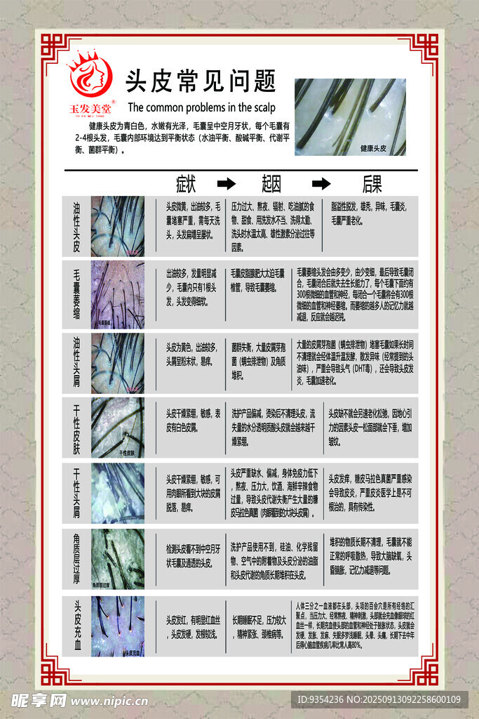 頭皮常見問題