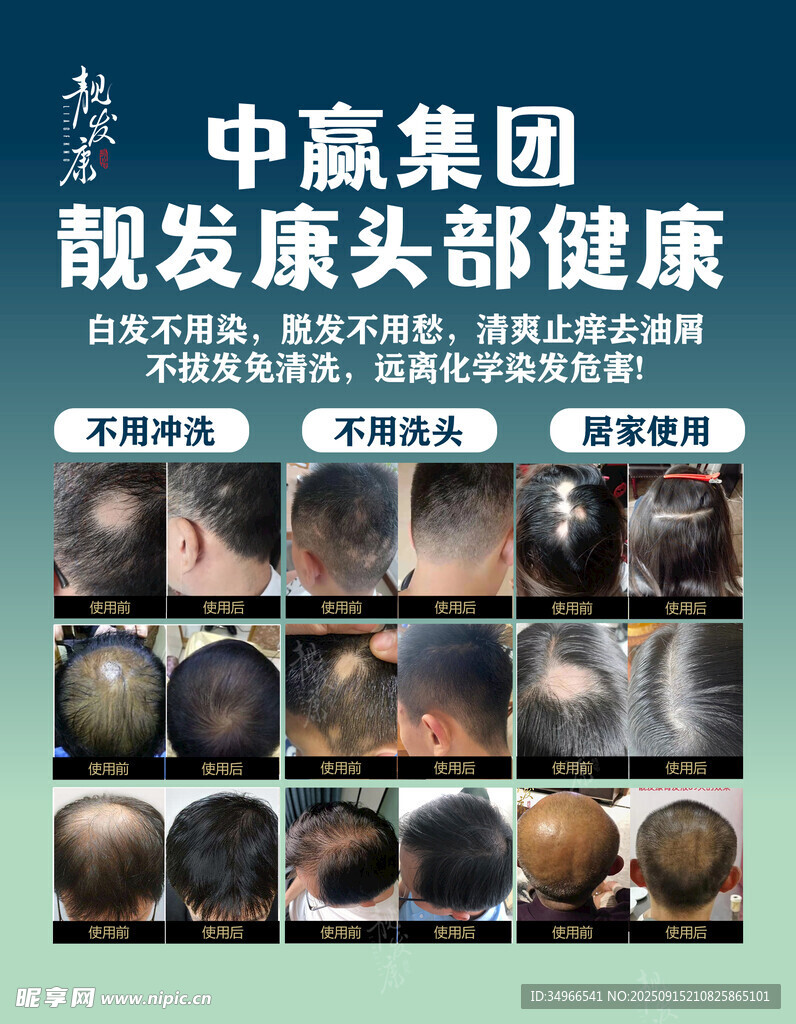 脫發(fā)頭部健康展示