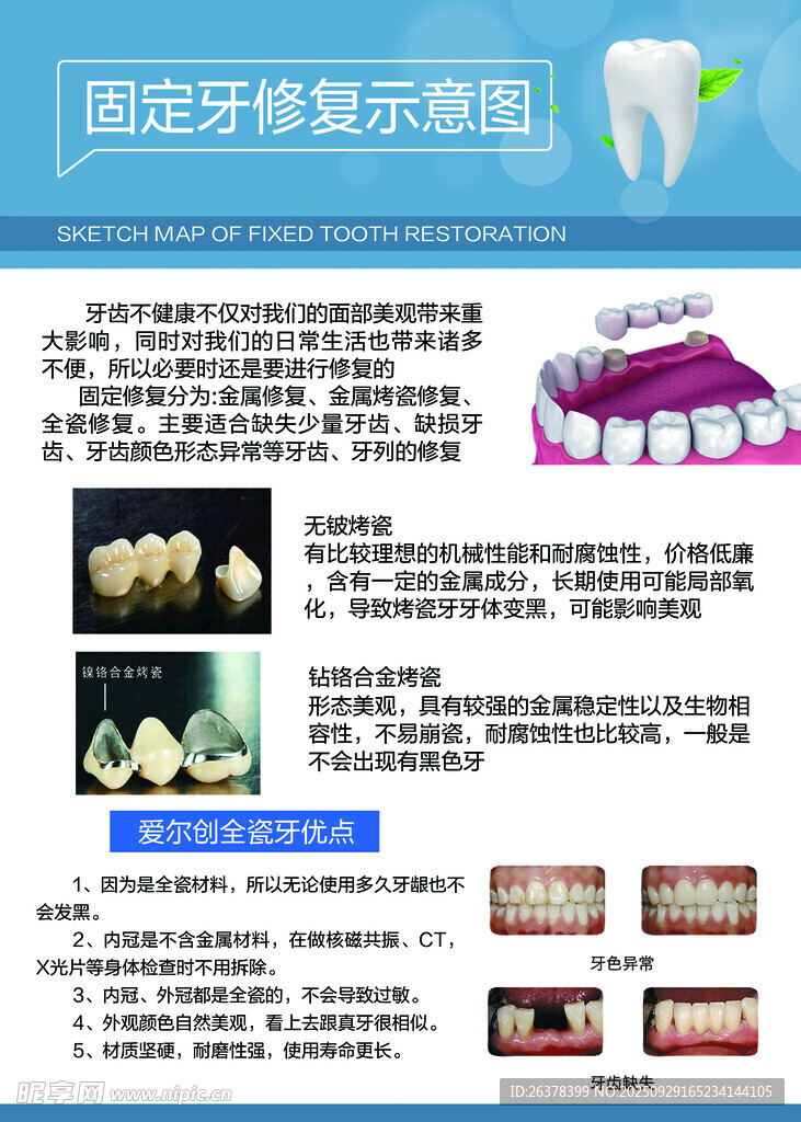 超聲波洗牙器展示介紹