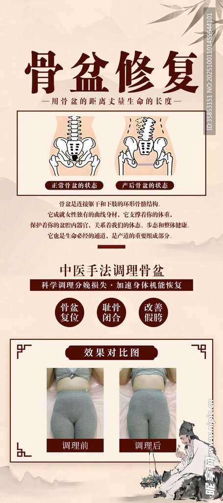 骨盆修復