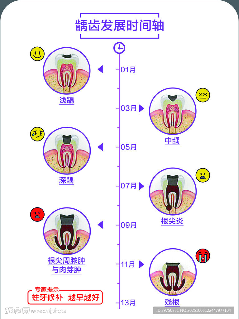 齲齒